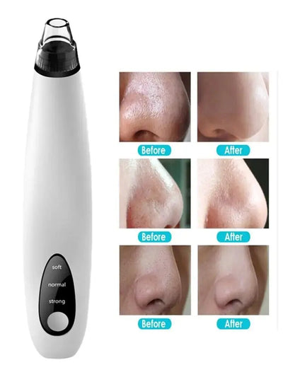 Electric Blackhead Remover Cleaner Face Diamond Pore Vacuum Suction White Heads My Store of soluchion